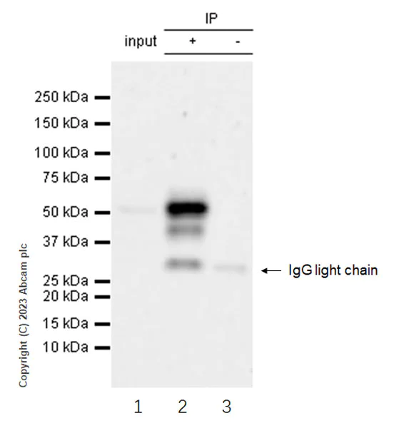 Immunoprecipitation - Anti-ZFYVE27 antibody [EPR28129-93] - BSA and Azide free (AB314324)