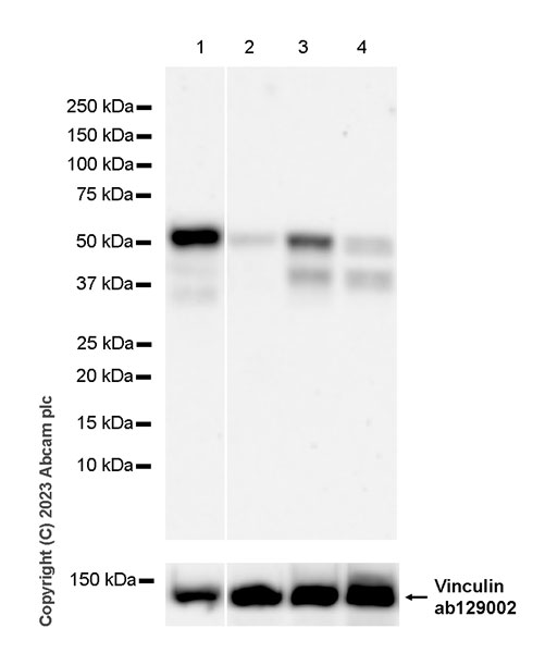 Western blot - Anti-ZFYVE27 antibody [EPR28129-93] - BSA and Azide free (AB314324), expandable thumbnail