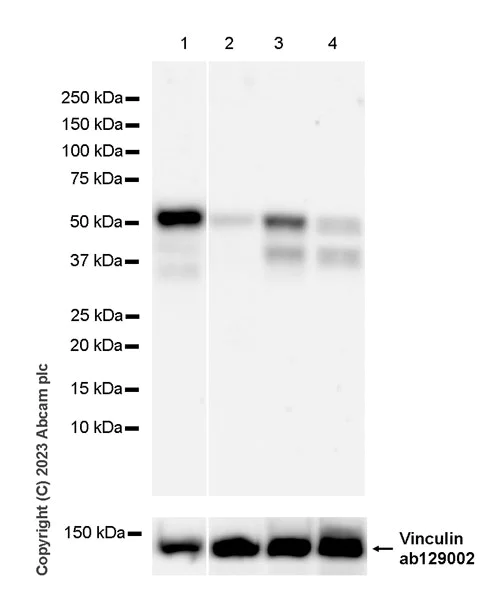 Western blot - Anti-ZFYVE27 antibody [EPR28129-93] - BSA and Azide free (AB314324)
