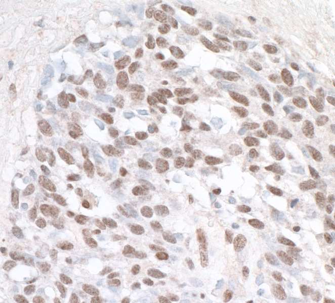 Immunohistochemistry (Formalin/PFA-fixed paraffin-embedded sections) - Anti-ZHX1 antibody (AB19356), expandable thumbnail