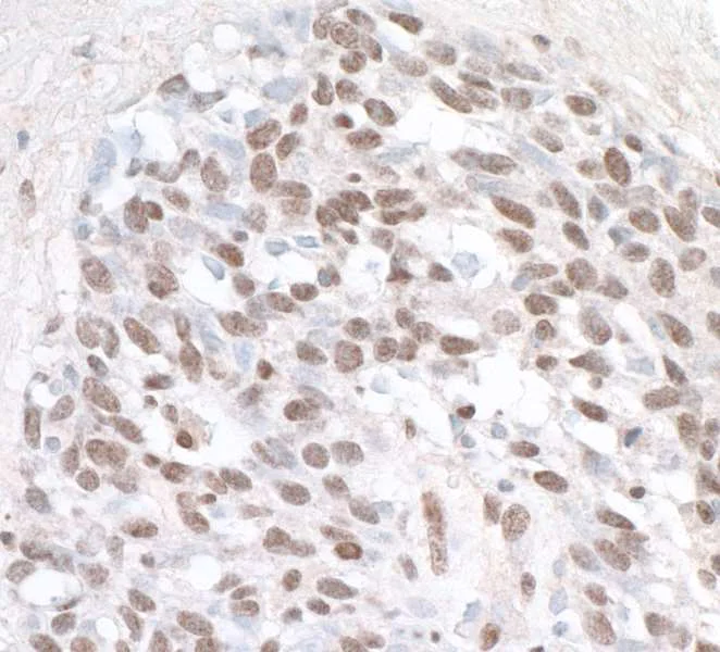 Immunohistochemistry (Formalin/PFA-fixed paraffin-embedded sections) - Anti-ZHX1 antibody (AB19356)