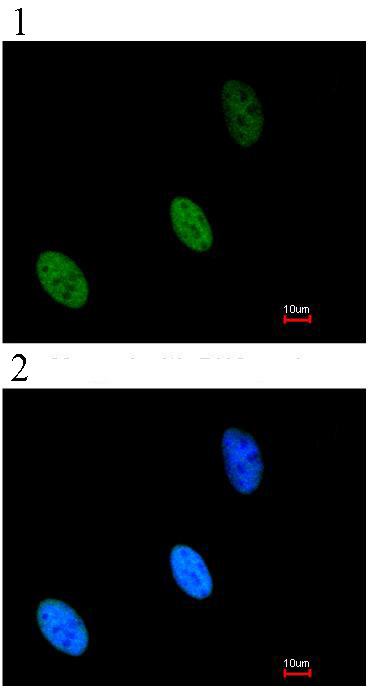Immunocytochemistry/ Immunofluorescence - Anti-ZHX2 antibody (AB96083)