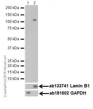 Western blot - Anti-ZHX2 antibody [EPR17303] (AB205532)