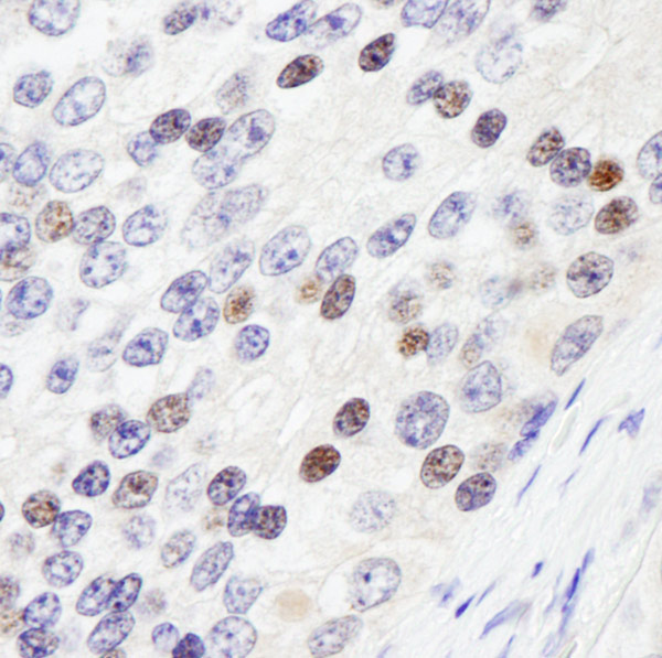 Immunohistochemistry (Formalin/PFA-fixed paraffin-embedded sections) - Anti-ZHX3 antibody (AB99353), expandable thumbnail