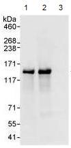 Immunoprecipitation - Anti-ZHX3 antibody (AB99353), expandable thumbnail