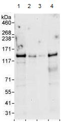 Western blot - Anti-ZHX3 antibody (AB99353), expandable thumbnail