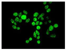 Immunocytochemistry/ Immunofluorescence - Anti-Zic1 antibody [EPR7291(2)] (AB134951)