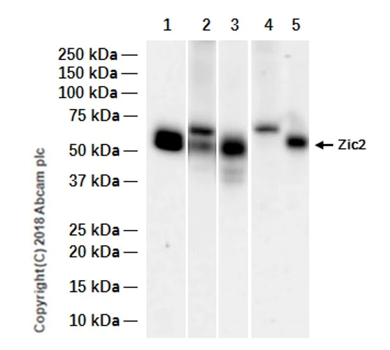 Western blot - Anti-Zic2 antibody [EPR7790] - BSA and Azide free (AB236069)