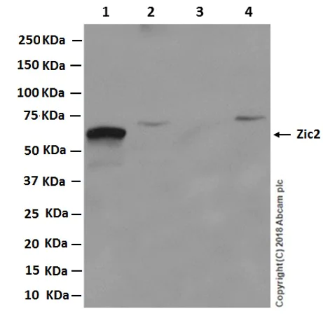 Western blot - Anti-Zic2 antibody [EPR7790] - BSA and Azide free (AB236069)