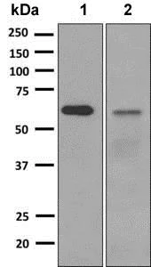 Western blot - Anti-Zic2 antibody [EPR7790] - BSA and Azide free (AB236069)
