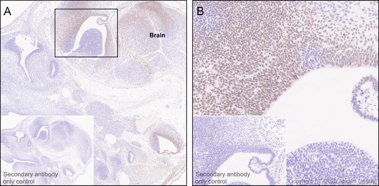 Immunohistochemistry (Formalin/PFA-fixed paraffin-embedded sections) - Anti-ZIC3 antibody [EPR30592-522] (AB325172)