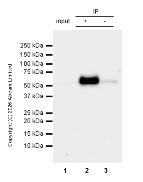Immunoprecipitation - Anti-ZIC3 antibody [EPR30592-522] (AB325172)