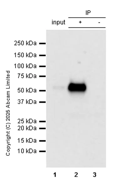 Immunoprecipitation - Anti-ZIC3 antibody [EPR30592-522] (AB325172)