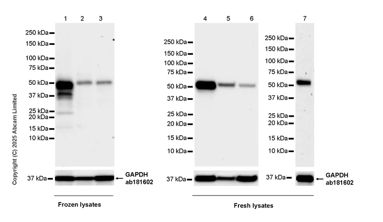 Western blot - Anti-ZIC3 antibody [EPR30592-522] (AB325172)