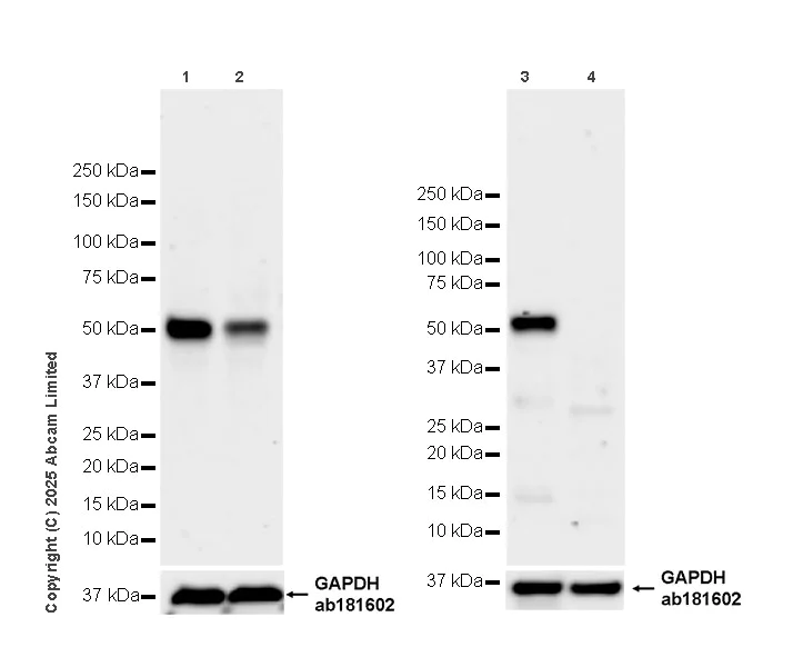 Western blot - Anti-ZIC3 antibody [EPR30592-522] (AB325172)
