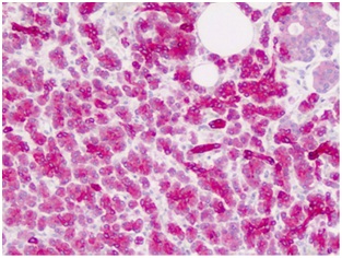 Immunohistochemistry (Formalin/PFA-fixed paraffin-embedded sections) - Anti-ZIC4 antibody - C-terminal (AB178512), expandable thumbnail