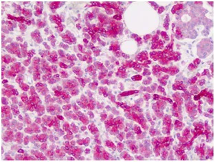 Immunohistochemistry (Formalin/PFA-fixed paraffin-embedded sections) - Anti-ZIC4 antibody - C-terminal (AB178512)