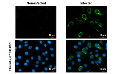 Immunocytochemistry/ Immunofluorescence - Anti-Zika virus Envelope protein antibody [HL1699] (AB308186)
