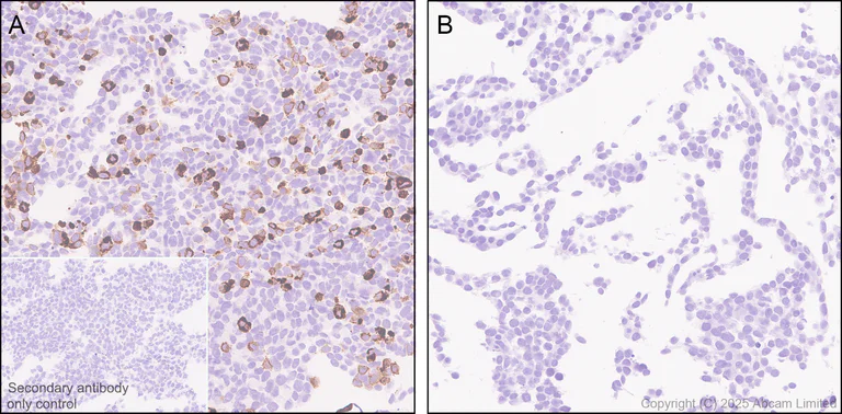 Immunohistochemistry (Formalin/PFA-fixed paraffin-embedded sections) - Anti-Zika virus envelope protein E antibody [EPR30864-521] (AB325556)