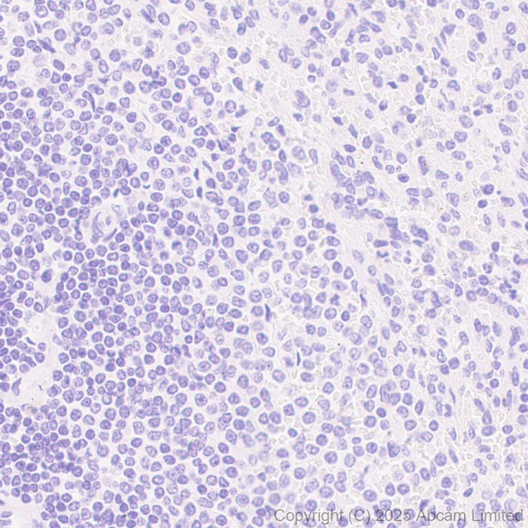 Immunohistochemistry (Formalin/PFA-fixed paraffin-embedded sections) - Anti-Zika virus envelope protein E antibody [EPR30864-521] (AB325556)