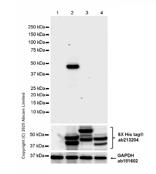 Western blot - Anti-Zika Virus NS1 antibody [B4] (AB218546)