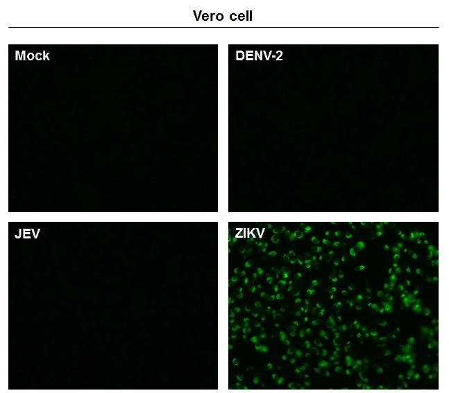 Immunocytochemistry/ Immunofluorescence - Anti-Zika virus NS1 protein antibody [GT5212] - BSA and Azide free (AB308409), expandable thumbnail