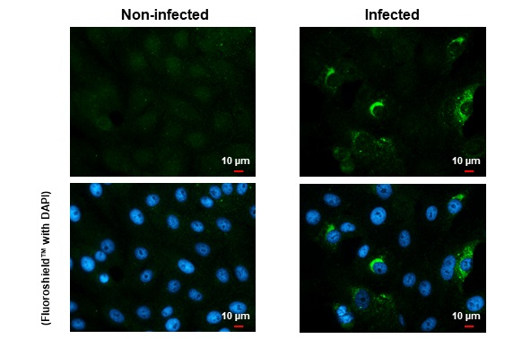 Immunocytochemistry/ Immunofluorescence - Anti-Zika virus NS1 protein antibody [GT5212] - BSA and Azide free (AB308409), expandable thumbnail