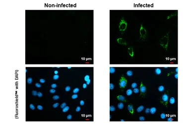 Immunocytochemistry/ Immunofluorescence - Anti-Zika virus NS4B protein antibody [HL1663] (AB308183)