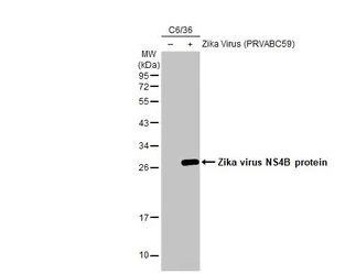 Western blot - Anti-Zika virus NS4B protein antibody [HL1663] (AB308183), expandable thumbnail
