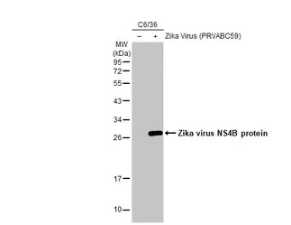 Western blot - Anti-Zika virus NS4B protein antibody [HL1663] (AB308183)