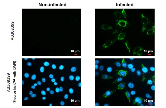 Immunocytochemistry/ Immunofluorescence - Anti-Zika virus NS4B protein antibody [HL1664] (AB308399)