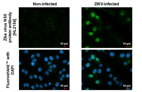Immunocytochemistry/ Immunofluorescence - Anti-Zika virus NS5 protein antibody [HL2154] - BSA and Azide free (AB327552)