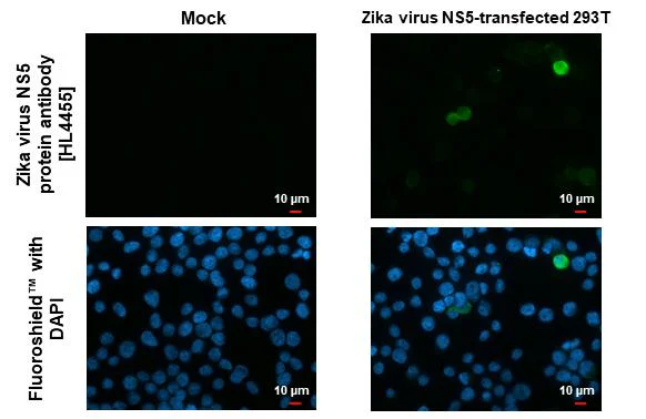Immunocytochemistry/ Immunofluorescence - Anti-Zika virus NS5 protein antibody [HL4455] - BSA and Azide free (AB327616)