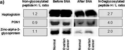 Western blot - Anti-Zinc Alpha 2 Glycoprotein antibody (AB47116)