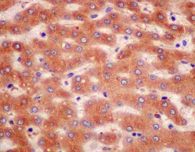 Immunohistochemistry (Formalin/PFA-fixed paraffin-embedded sections) - Anti-Zinc Alpha 2 Glycoprotein antibody [EPR14425(B)] (AB180574)