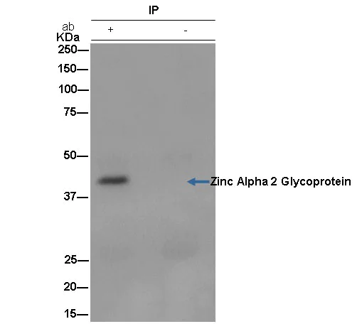 Immunoprecipitation - Anti-Zinc Alpha 2 Glycoprotein antibody [EPR14425(B)] - BSA and Azide free (AB250225)