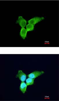 Immunocytochemistry/ Immunofluorescence - Anti-Zinc finger antiviral protein antibody (AB154680), expandable thumbnail