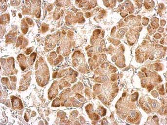 Immunohistochemistry (Formalin/PFA-fixed paraffin-embedded sections) - Anti-Zinc finger antiviral protein antibody (AB154680), expandable thumbnail