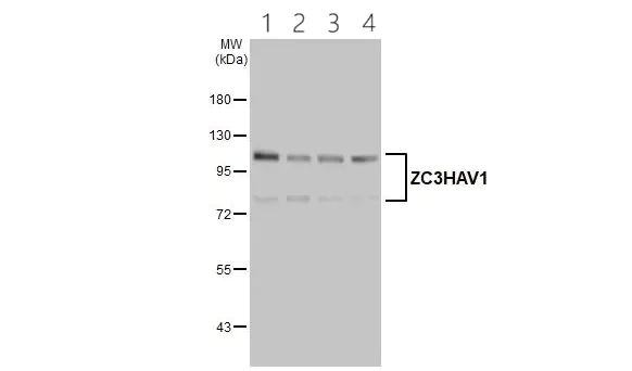 Western blot - Anti-Zinc finger antiviral protein antibody (AB154680)