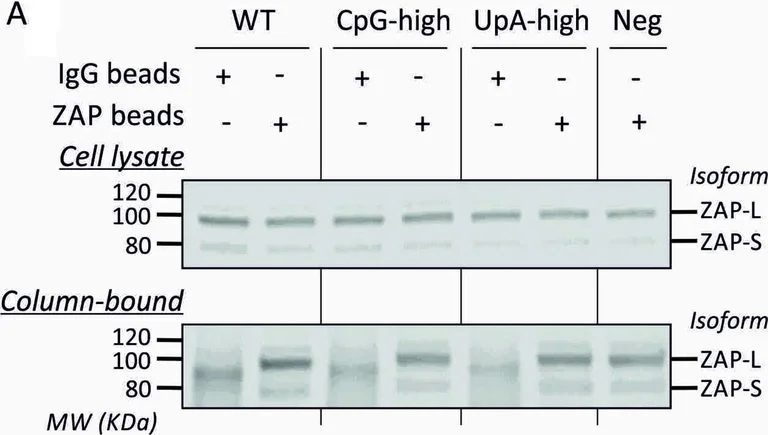 Western blot - Anti-Zinc finger antiviral protein antibody (AB154680)