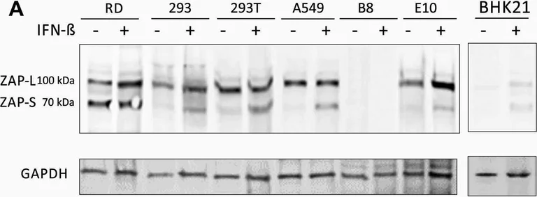 Western blot - Anti-Zinc finger antiviral protein antibody (AB154680)