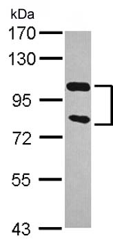Western blot - Anti-Zinc finger antiviral protein antibody (AB154680), expandable thumbnail