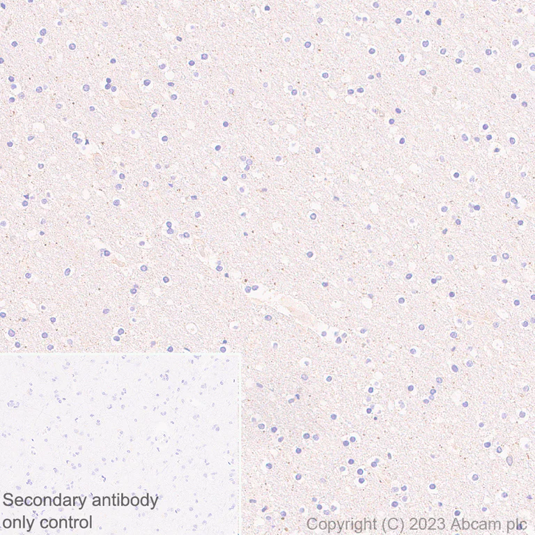 Immunohistochemistry (Formalin/PFA-fixed paraffin-embedded sections) - Anti-Zinc finger antiviral protein antibody [EPR28538-63] (AB314899)