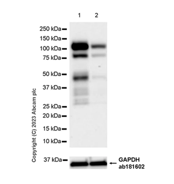 Western blot - Anti-Zinc finger antiviral protein antibody [EPR28538-63] (AB314899)