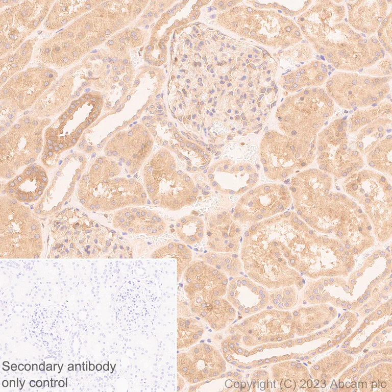 Immunohistochemistry (Formalin/PFA-fixed paraffin-embedded sections) - Anti-Zinc finger antiviral protein antibody [EPR28538-63] - BSA and Azide free (AB314900)