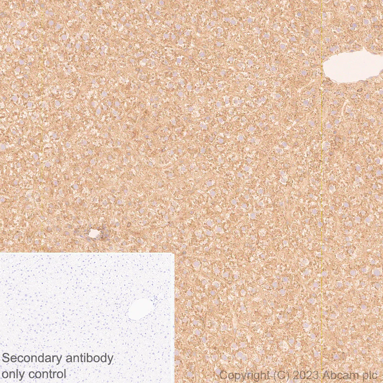 Immunohistochemistry (Formalin/PFA-fixed paraffin-embedded sections) - Anti-Zinc finger antiviral protein antibody [EPR28538-63] - BSA and Azide free (AB314900)