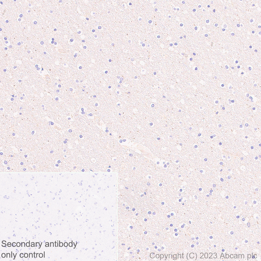 Immunohistochemistry (Formalin/PFA-fixed paraffin-embedded sections) - Anti-Zinc finger antiviral protein antibody [EPR28538-63] - BSA and Azide free (AB314900)