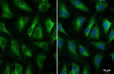 Immunocytochemistry/ Immunofluorescence - Anti-Zinc finger antiviral protein antibody [HL1884] - BSA and Azide free (AB313866), expandable thumbnail