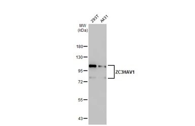 Western blot - Anti-Zinc finger antiviral protein antibody [HL1884] - BSA and Azide free (AB313866), expandable thumbnail