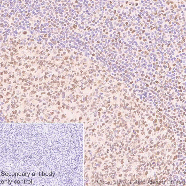 Immunohistochemistry (Formalin/PFA-fixed paraffin-embedded sections) - Anti-Zinc finger MIZ domain-containing protein 1 antibody [EPR29807-525] (AB326070)